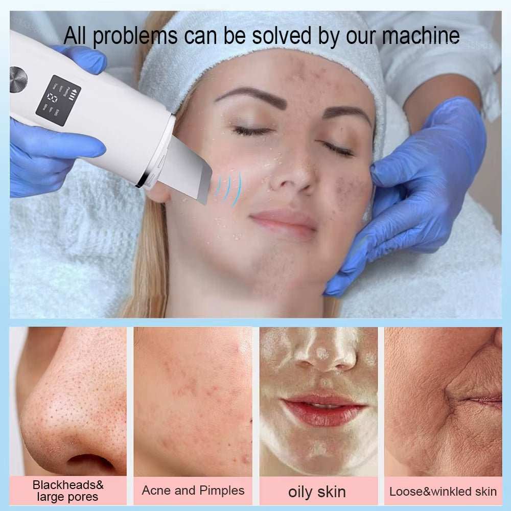 Ultrasonic Face Scrubber Facial Peeling Skin Scrubber Deep Facial Cleaning Spatula Acne Pore Ultrasonic Scrubber Facial Cleanser - AMIR BAGS INDIA PRIVATE LIMITED