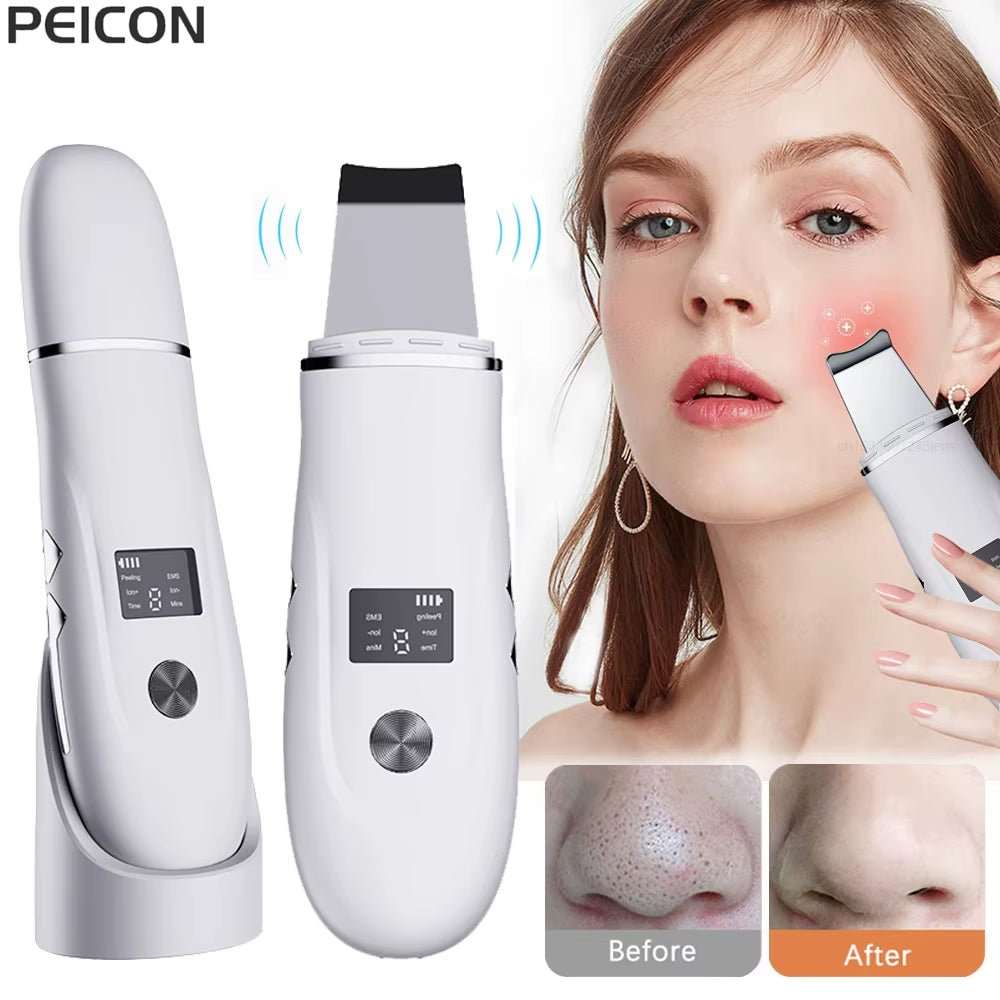 Ultrasonic Face Scrubber Facial Peeling Skin Scrubber Deep Facial Cleaning Spatula Acne Pore Ultrasonic Scrubber Facial Cleanser - AMIR BAGS INDIA PRIVATE LIMITED
