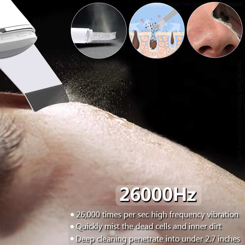 Ultrasonic Face Scrubber Facial Peeling Skin Scrubber Deep Facial Cleaning Spatula Acne Pore Ultrasonic Scrubber Facial Cleanser - AMIR BAGS INDIA PRIVATE LIMITED